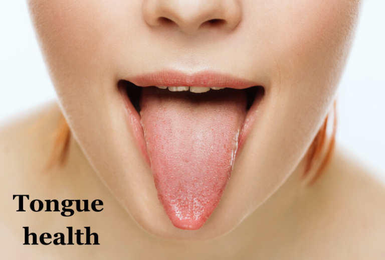 Tongue-health