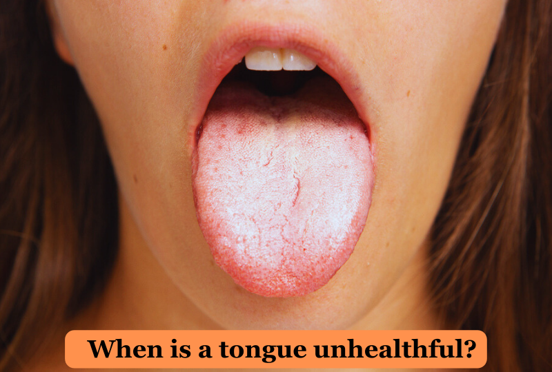 When-is-a-tongue-unhealthful