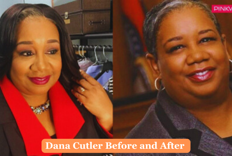 Dana-Cutler-Before-and-After